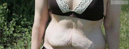 体重320斤的胖妞，成功减肥175斤后逆袭成大美女(图1)