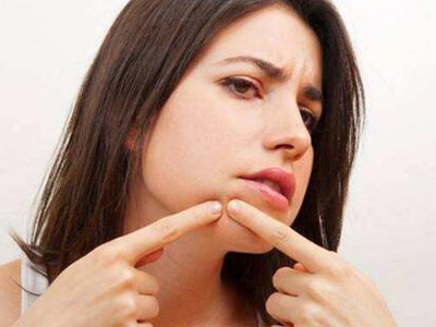 嘴角长痘是什么原因？怎么调理？(图4)