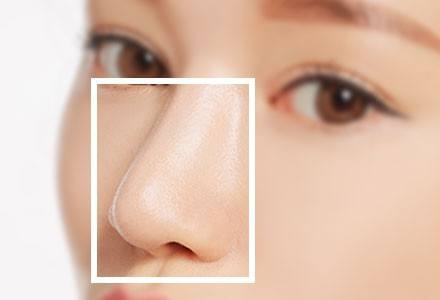 隆鼻手术有哪些危害？隆鼻当心这5种后遗症(图3)