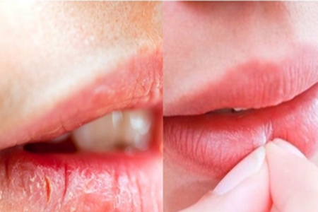 如何去除嘴唇角质？这几个方法让唇部更加干净粉嫩！(图3)