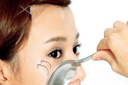 女生如何去除黑眼圈，这几个方法有效消除双眼更加亮丽(图2)