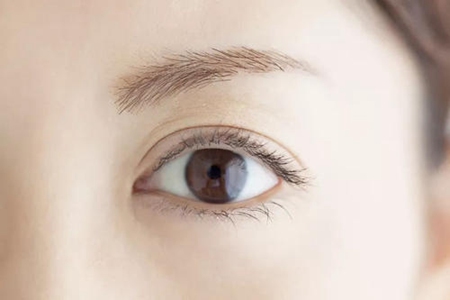 眼皮浮肿是什么原因引起的，这三个女性上眼皮浮肿的原因(图3)