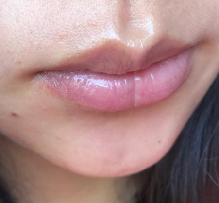 几个坏习惯，会让唇部越来越丑，不改掉很难提升颜值(图1)