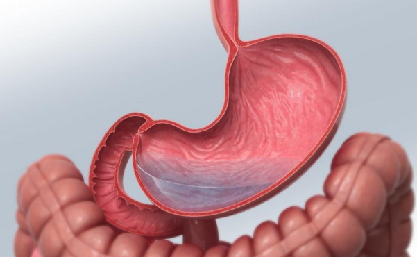 胃病应该注意什么饮食？肠胃应该如何保养？(图4)