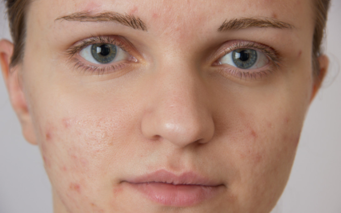 为什么脸上的皱纹越来越多?持续做好几件事，皮肤慢慢变好(图3)