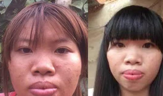 丑女孩从小被嘲笑，整容变美女嫁富二代，生完孩子离婚后又有新欢(图1)