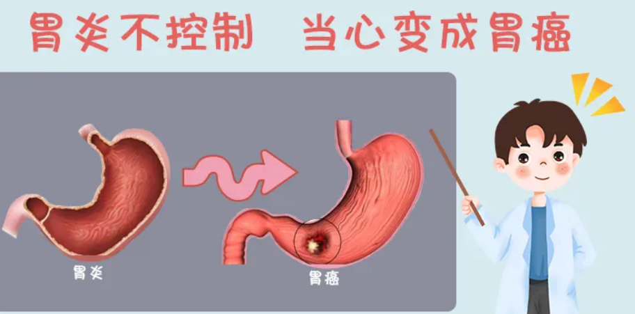 无论男女，如果口腔都有这三种异常，警惕可能是胃癌(图2)