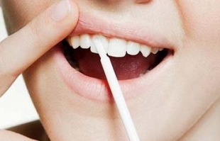 牙齿整形后的日常护理与注意事项
