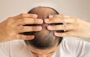 头发少要怎么保养 预防脱发十秘诀