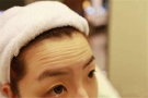 女性如何去除抬头纹？这几个方法抚平额头展现平滑肌肤