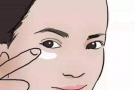 女生如何去除眼袋，这五个方法教您巧妙消除无烦恼