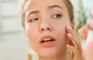 脸部为什么经常出油，是皮肤缺水的表现吗？